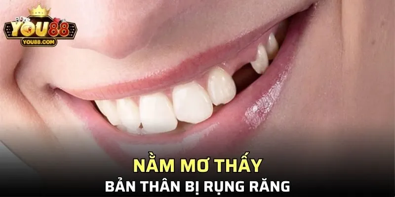 Thành viên nằm mộng thấy hình ảnh bản thân rụng răng